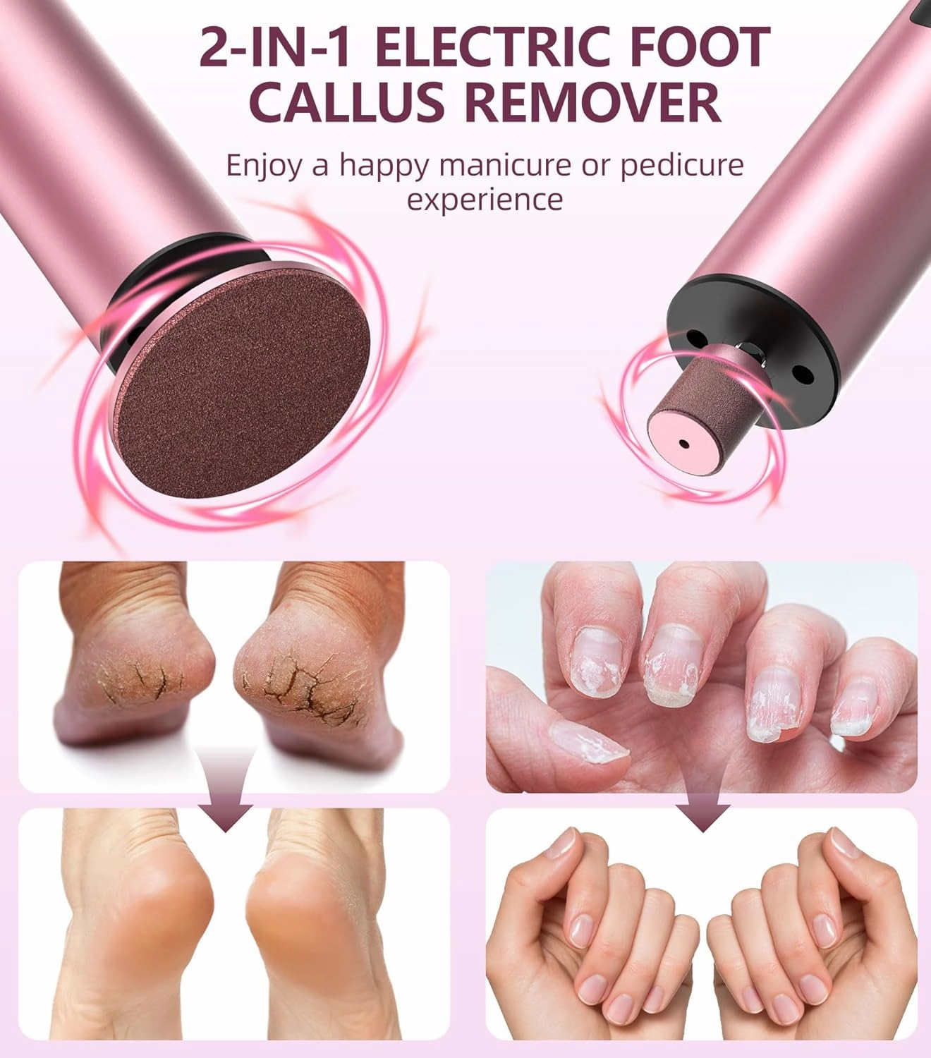 Electric Foot Callus Remover(6 Speed), 2 in 1 Electric Foot File Nail Grinder, Rechargeable Foot Sander with Sandpaper Disk and Nail Drill Bits, Callus Remover for Feet for Dead Skin-Pink