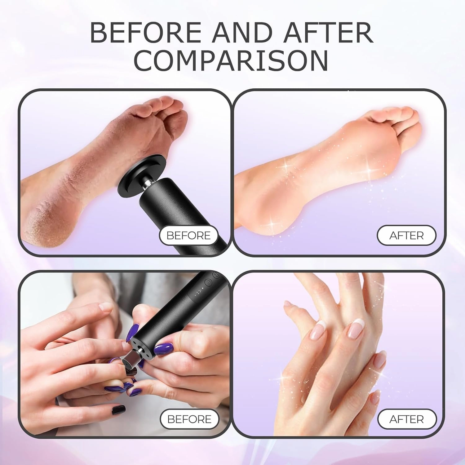krofaue Electric Callus Remover Kit - USB Rechargeable 2 in 1 Foot Scrubber & Dead Skin Remover - 6 Gears Electric Nail Buffer Set for Daily Care - Black